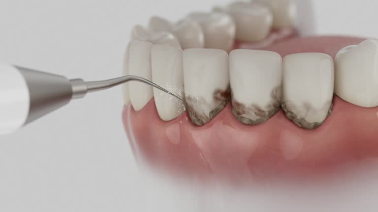 Reliable Wisdom Tooth Removal contractor in St. Clair County County, MI by Dentist Open Now